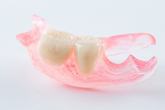 入れ歯（義歯）の治療 - 宮崎けやき歯科（宮崎市吉村町）